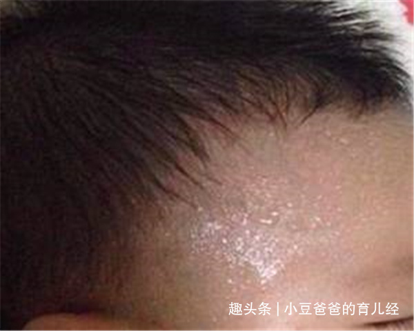 钙片|孩子一睡觉就出汗，是身体虚弱还是缺钙父母记住3个“关键词”