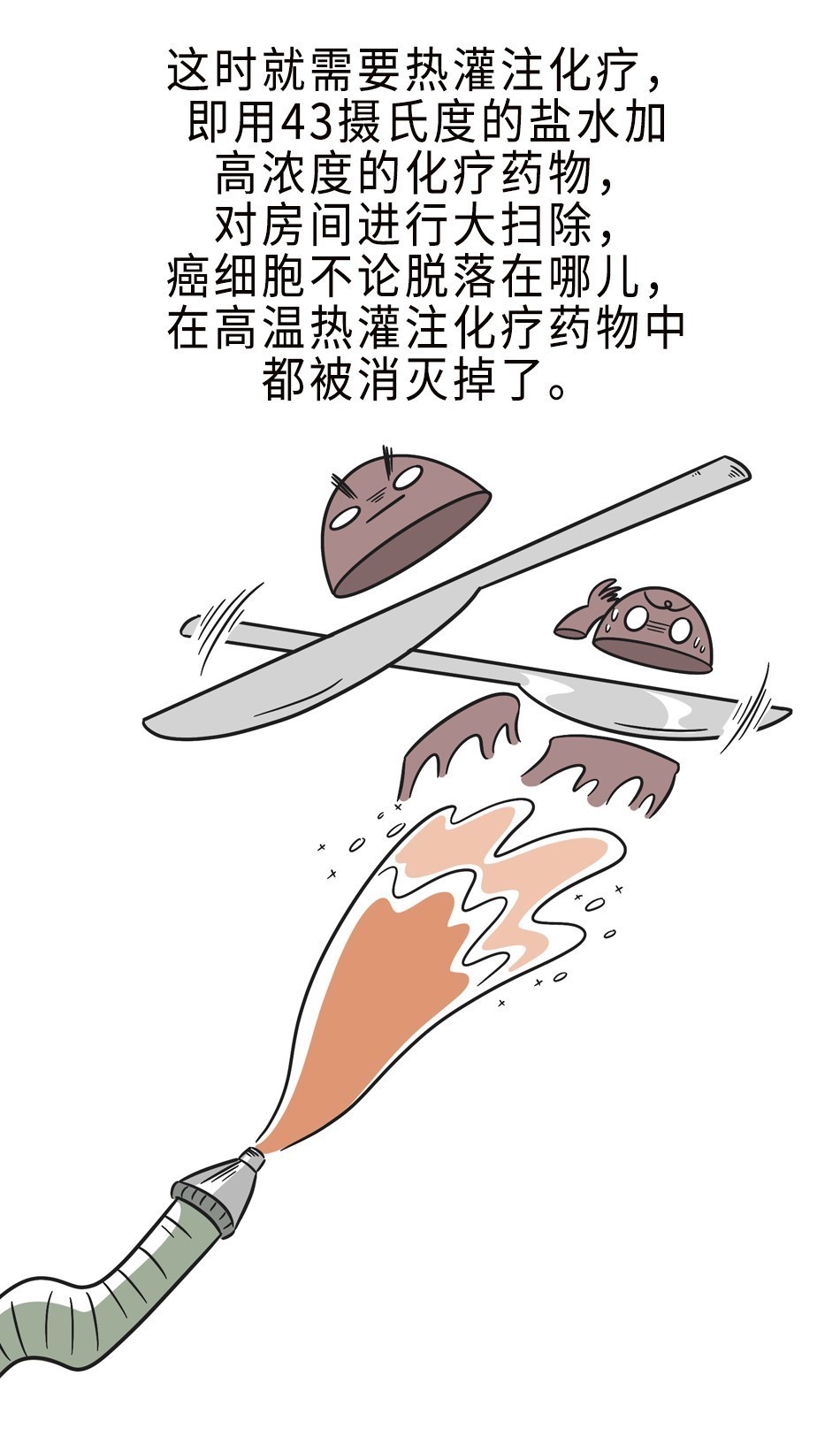 李雁|“老大难”腹膜癌能治吗?