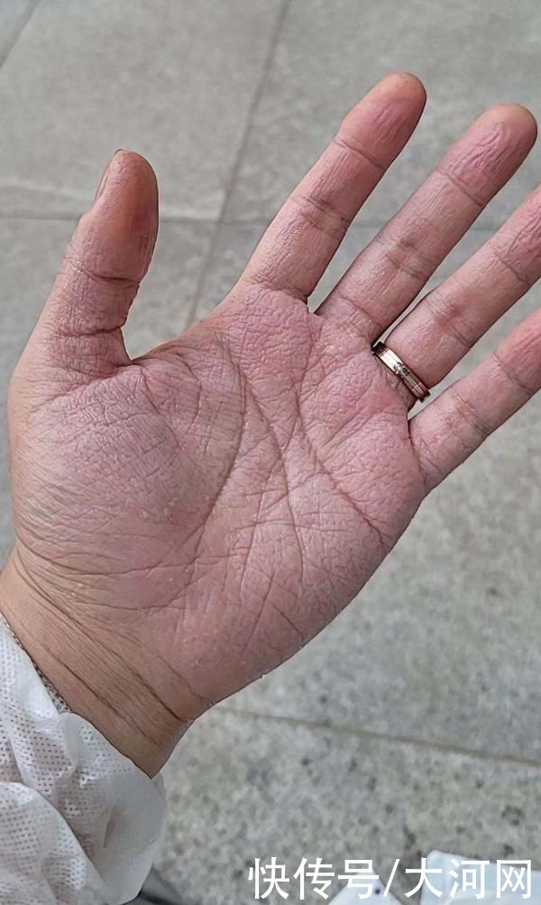 远程|“移”起战“疫”！14小时打通5G远程救治“生命通道”，他们是如何做到的？