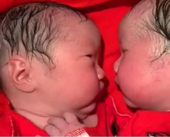 心灵感应|双胞胎姐妹出生20分钟后,姐姐对妹妹的行为,让护士泪目了