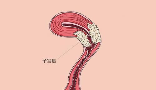 吃饭和寿命有关？吃饭时，保持3个习惯的人，身体一般会比较好