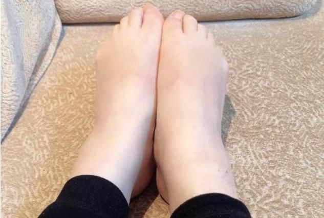 公孙穴|每晚睡前坚持拉足背，让你活到98，比走一万步都管用