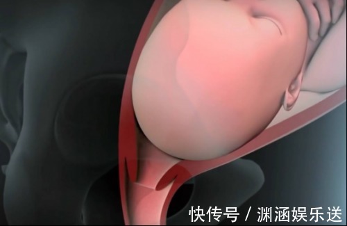 小李|产道那么小婴儿是怎么出来的这张图很生动,看完感叹母爱伟大