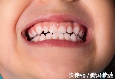 恒牙|7岁男孩乳牙未掉,恒牙又长,医生检查后说道幸亏来得及时