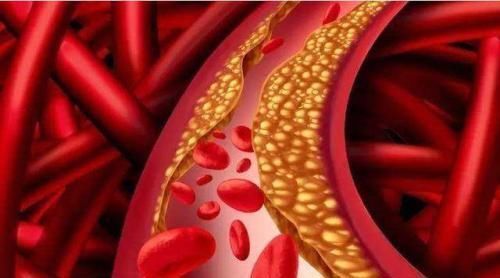 甘油三酯升高|甘油三酯过高,1植物泡水喝,甘油三酯降低了,头不晕手不麻