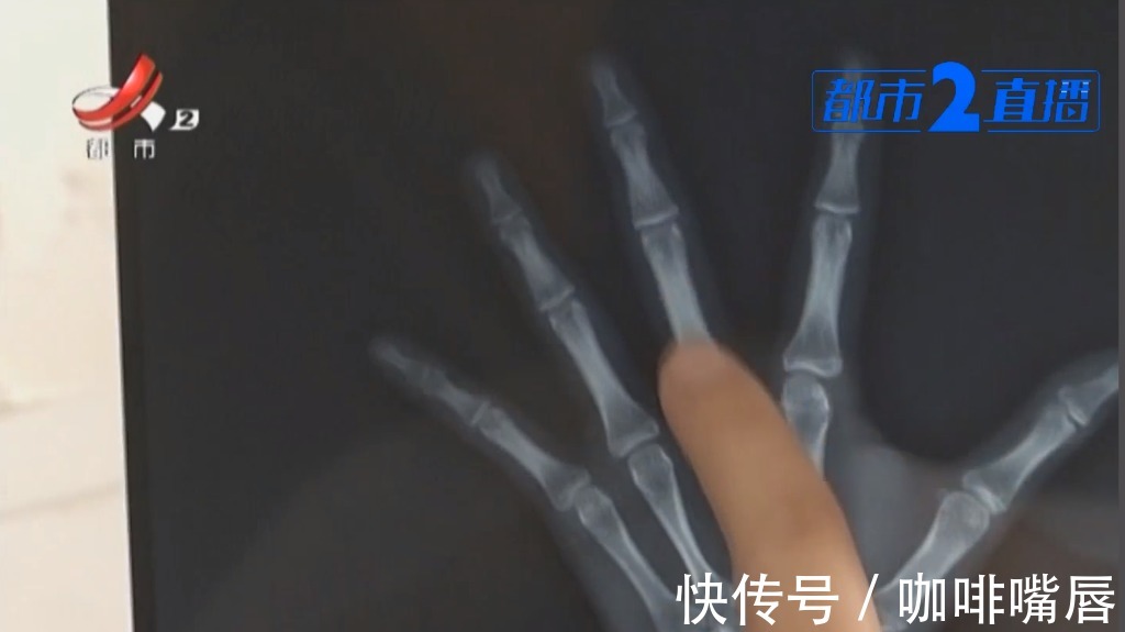 江西省儿童医院|孩子身高有点矮?医生:暑期是孩子长高的“黄金期”