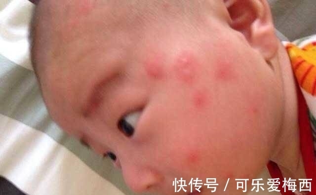 宝宝|被蚊子“选中”的宝宝,是因为甜度高吗?蚊子的口味其实是这样的