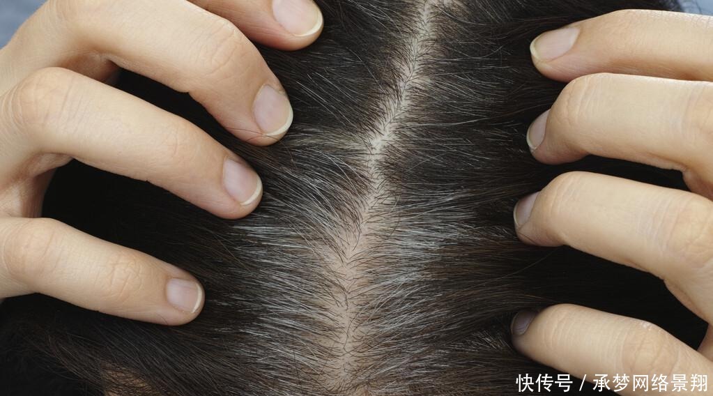 洗头|女孩子出门要清爽，头发爱出油可能是因为这5点，你中招了吗