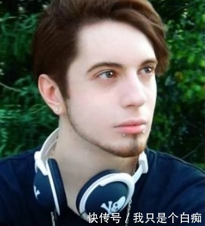 怪物|男子为变成精灵王子,削尖耳朵整成怪物,网友:整容前太帅了