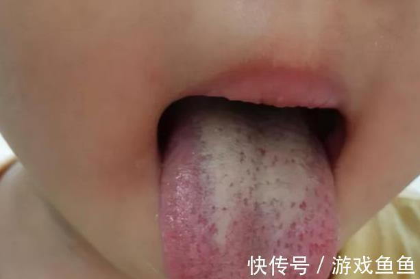 儿科医生|12岁男童补钙3年,身高却只有132厘米,医生:常吃3饭会长个才怪