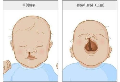 胎儿|5类孕妇容易生出畸形宝宝！孕前孕后跟我学，可以降低风险