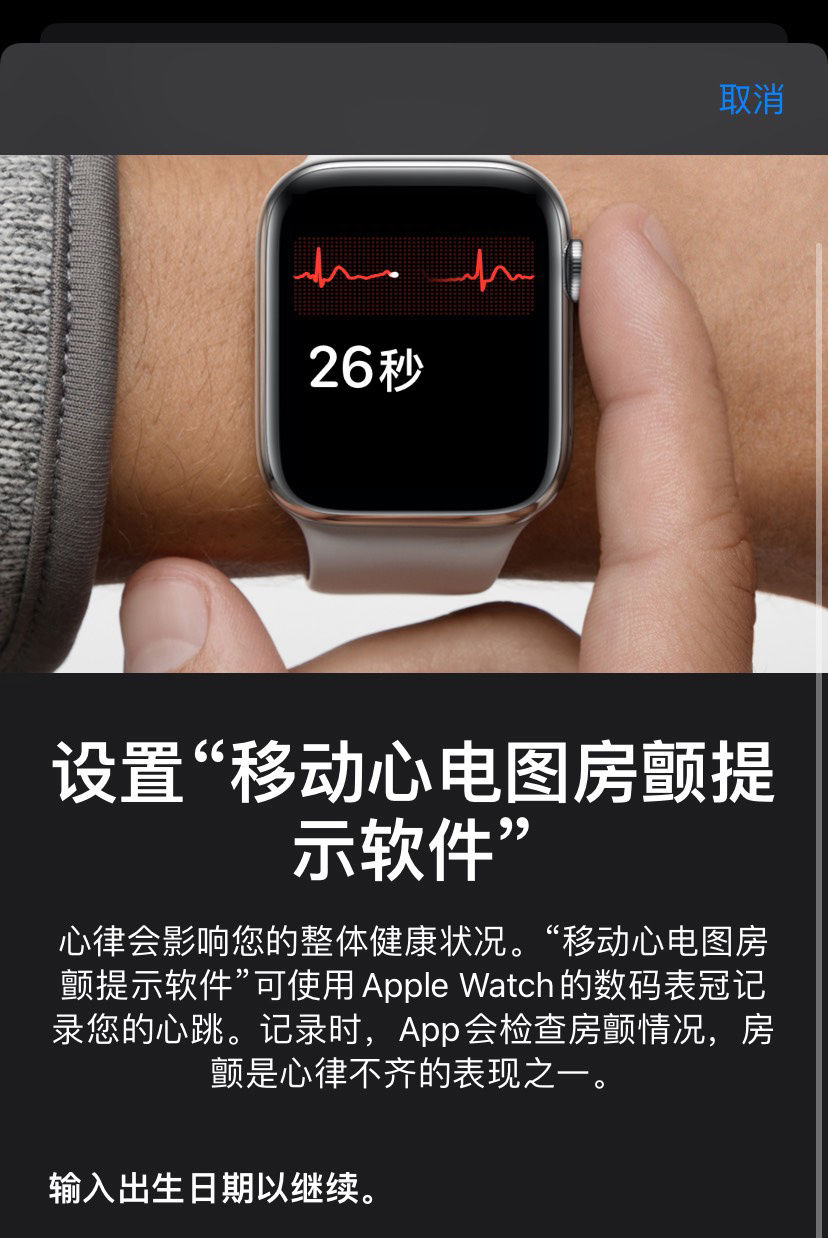 心电图|iOS 15.2 ECG已翻译成“移动心电图房颤提示软件”