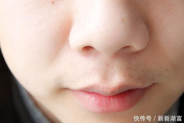 皮肤|鼻子上挤出白色的物体是什么?千万别用手挤,三个方法帮你去除