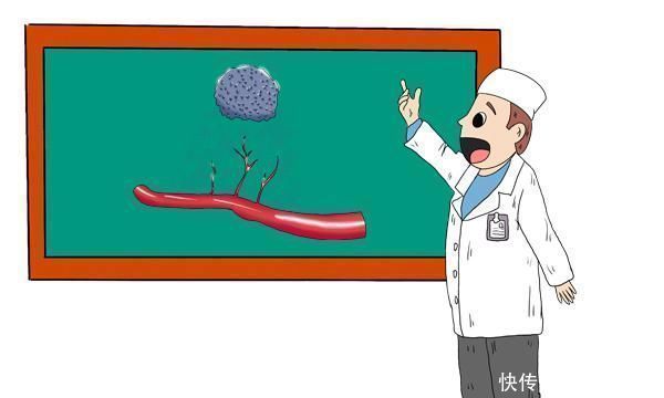 癌症|肿瘤复发就是癌症晚期吗?复发还能治愈吗?该如何预防肿瘤复发?