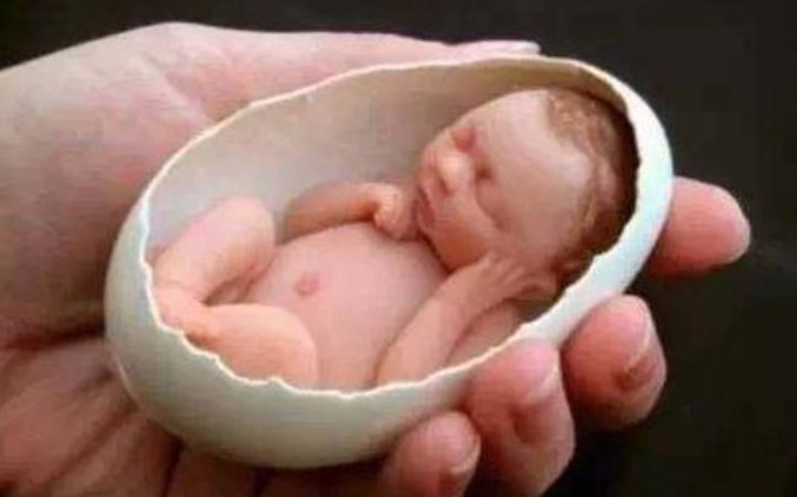 小头症|世界上最小的婴儿,曾经把蛋壳当成摇篮,如今却变成了这副模样!