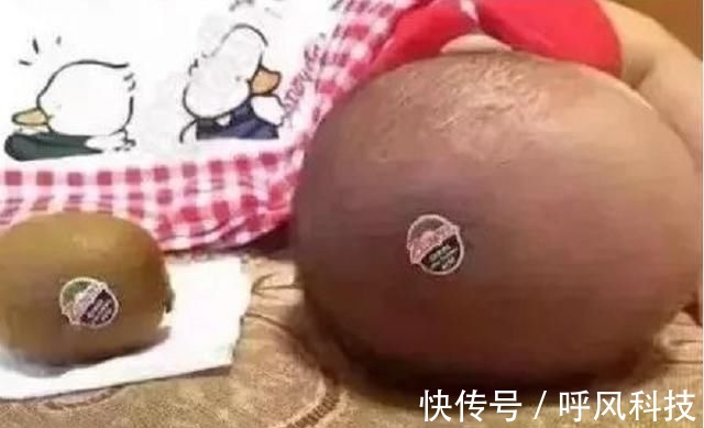 孩子|“睡枕头”和“不睡枕头”的娃,长大后差距一目了然,爹妈要注意