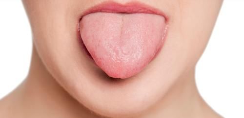 瘀斑|从舌望心，你的心有没有问题，看舌就知道了