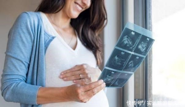 染色体|孕期B超单直接反应胎儿状况,这5处孕妈要学会看懂,医生不会详说
