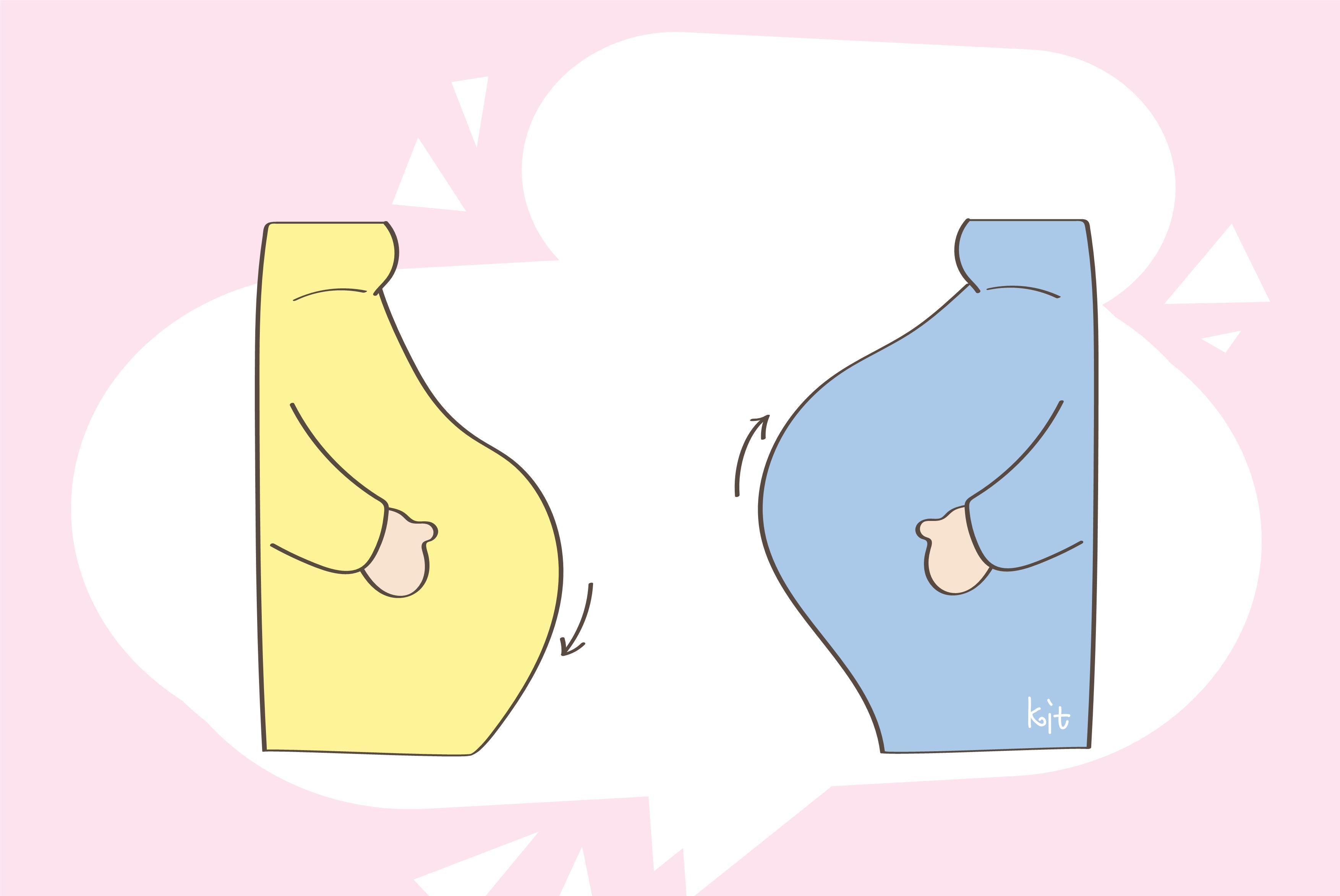 下怀|孕妈上怀与下怀,区别不仅在于感觉,胎儿风险也不同