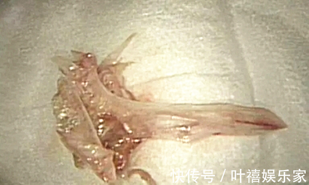 男童|男童胃里惊现一团胶水,经查明是吃了这种零食,网友花钱坑孩子