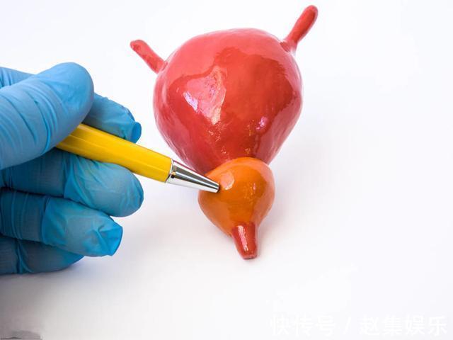 西红柿|得了前列腺炎,会出现哪些症状医生这3种自我疗法,很不错