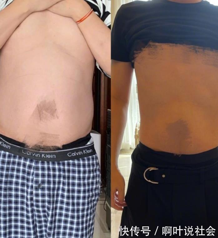 过度肥胖|30岁湖南台主持2个月暴瘦30斤啤酒肚变腹肌,曾因肥胖长脂肪瘤