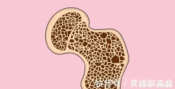 骨骼|骨科医生提醒得了骨癌,身体常会有4个表现,越早发现越好
