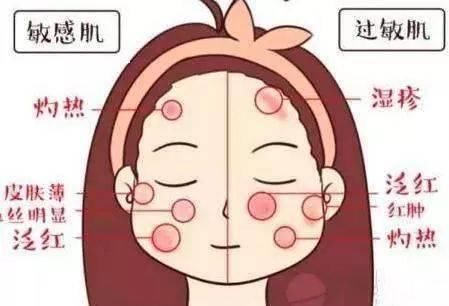 还不知道自己是什么肤质？来测测就知道了！