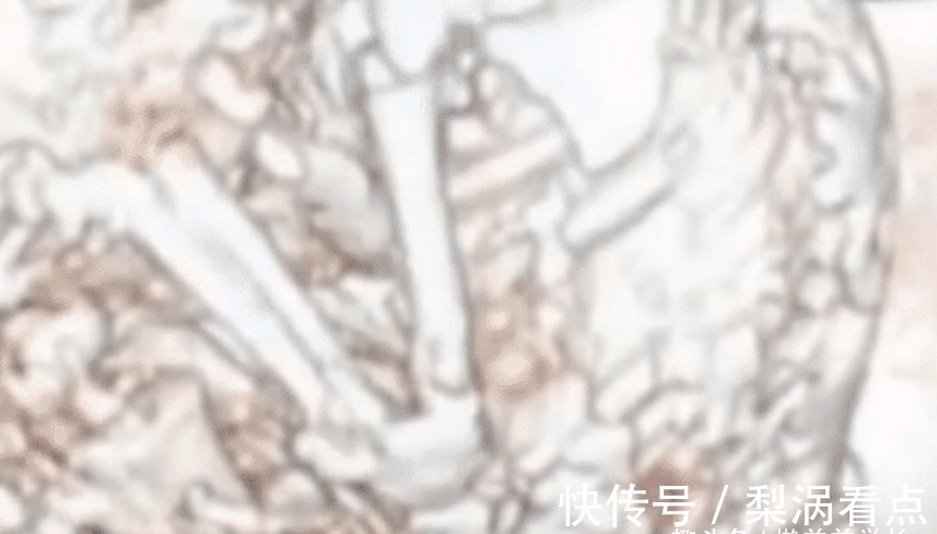 怀孕|怀孕61年之久?“婴儿”迟迟不肯出生,被发现时母亲已年近百岁