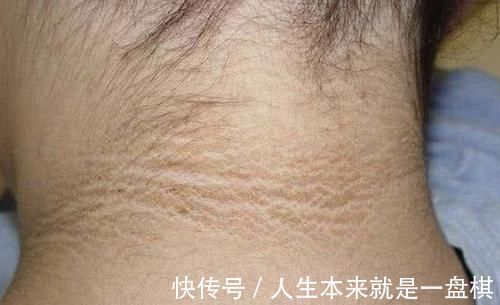 零食|6岁女儿脖颈发黑洗不掉,送医院检查,医生的解释令宝妈哭笑不得