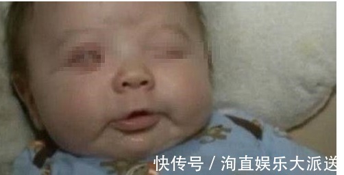 怒斥|孩子出生就没有眼睛,医生怒斥宝妈谁让你怀孕乱吃的