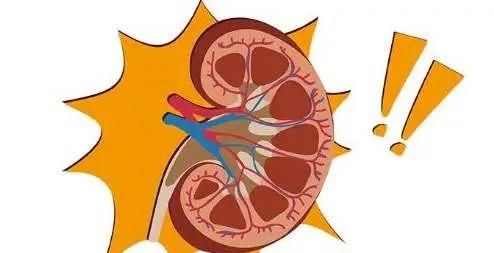 便捷|111人集體性中毒，患上腎衰竭！三分鐘的便捷，用一生的健康來換