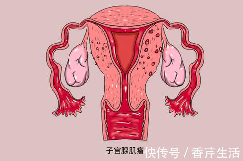 乳腺增生|绝经只有坏处,没有任何好处?医生:绝经后,3个好处可获得