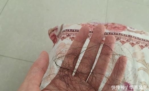 头上有这“3个表现”，很可能是有螨虫“做窝”，尽早处理一下