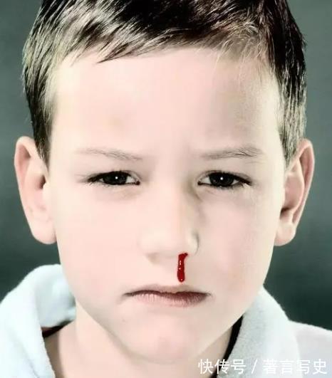 小杰|男孩鼻子流血,爸爸的三个果断做法,值得很多家长学习