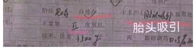 杜新枝|淮医提供92年病历，郭威明明是顺产，为何却标注着手术儿常规护理