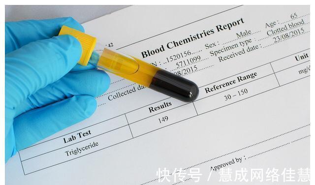 甘油三酯|不吃药,真能降血脂吗?医生确认了:能!但要认准这2种高血脂