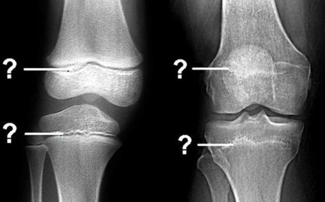 孩子|要想孩子冲破“身高封锁线”,建议家长抓住三个信号,能多长5cm