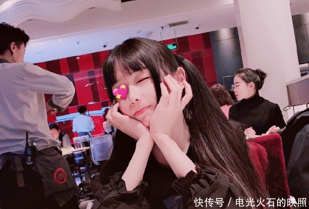 蔡萝莉发际线上移,为了美丽植发11个小时,一个毛囊报价12元