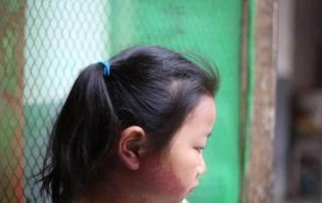 诱人|孕妈在孕期,尽量不做4件事,避免宝宝脸上长胎记,孕妈别不在意