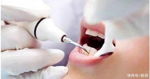 胎儿|怀孕期间，这项检查孕妈最好别做，浪费钱还不准确!