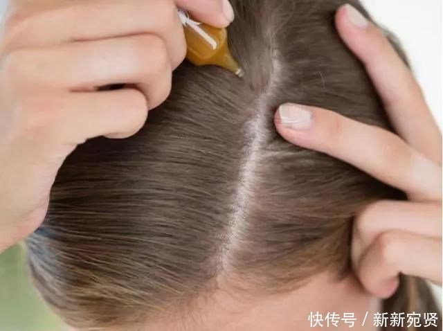 头发上有这“4个现象”,可能是长螨虫了,教你一招,轻松除螨