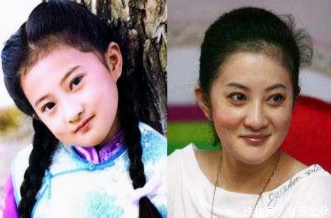 小时候|为什么有些孩子小时候漂亮，长大却长“残”了，两大因素不可忽略