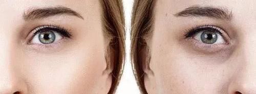 平价好物还是智商税?彩妆避雷特辑——遮瑕篇