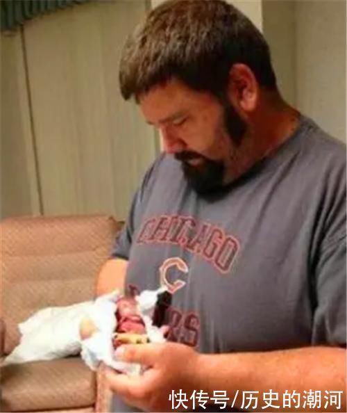 体重|18年了,那个出生仅280克,曾打破世界纪录的女婴,如今已认不出