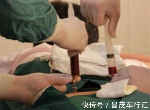 孩子|脐带血=救命血?伴随孩子降生的这份“礼物”,到底要不要留存?