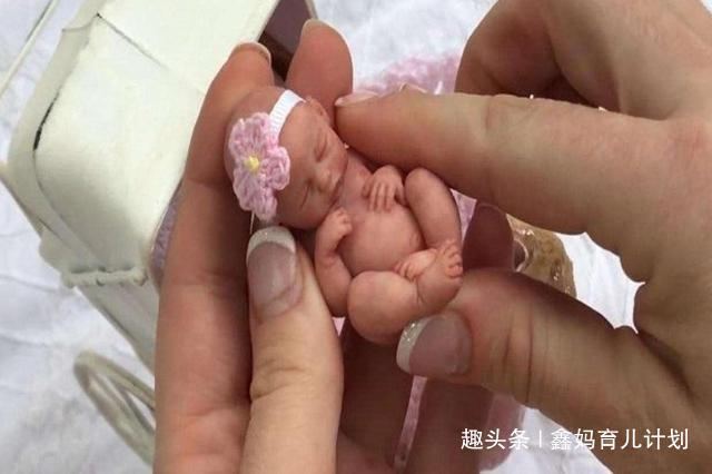 体重|14年过去了,那个出生体重仅0.56斤的世界最小婴儿,现如今怎样了