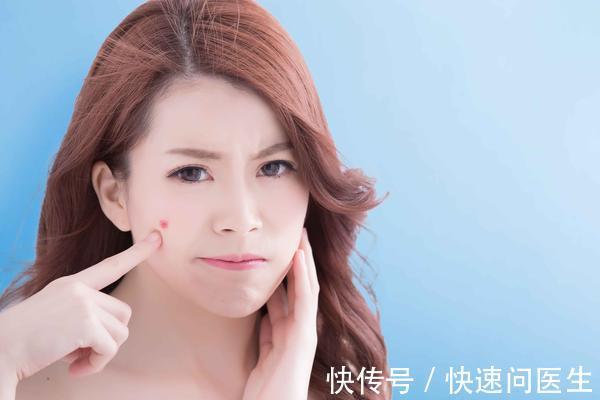 彩妆 脸上长了痘痘?不用着急,分享4招,帮助脸庞恢复白净