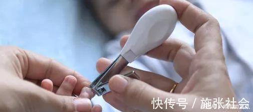 趾甲|给婴幼儿剪指甲可不简单, 我的孩子被剪成了甲沟炎