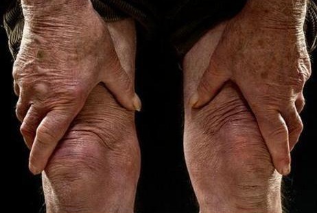 膝关节炎|膝关节炎反复折磨怎么办教你一个妙招就能调理，在家轻松做！